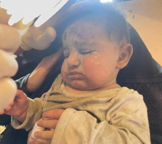 الصبر  في زمن الجراح ،،،، و أمل لا ينطفئ